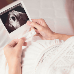 woman looking at an ultrasound image